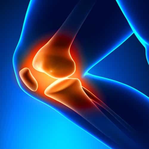 3 Cheapest Countries for Knee Replacement Surgery